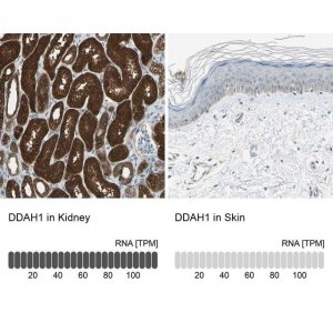 Anti-DDAH1 antibody produced in rabbit 