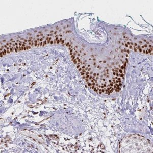 Anti-DDB2 antibody produced in rabbit 