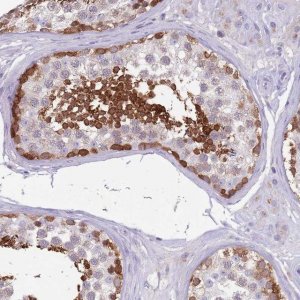 Anti-DDHD1 antibody produced in rabbit 