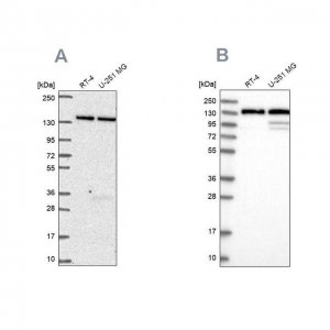 Anti-DDX46 antibody produced in rabbit HPA057501-100UL