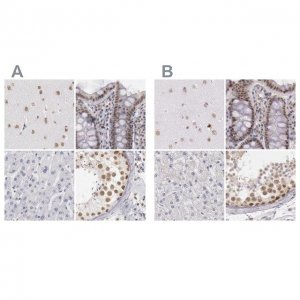 Anti-DGCR14 antibody produced in rabbit HPA001221-100UL
