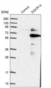 Anti-DGCR14 antibody produced in rabbit HPA001221-100UL