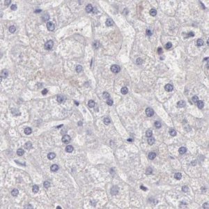 Anti-DGCR14 antibody produced in rabbit HPA001222-100UL