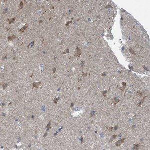 Anti-DGKZ antibody produced in rabbit 