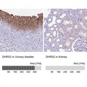 Anti-DHRS2 antibody produced in rabbit 