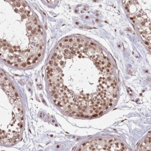 Anti-DHX8 antibody produced in rabbit 