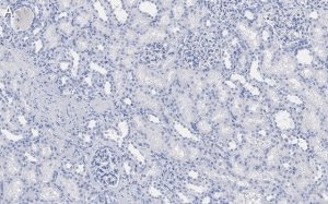 Anti-DIP2B Antibody, clone 2C8, ZooMAb� Rabbit Monoclonal 