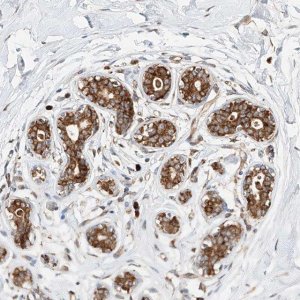 Anti-DIRAS3 antibody produced in rabbit 