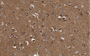 Anti-DKK3 Antibody, clone 3H17 ZooMAb� Rabbit Monoclonal 
