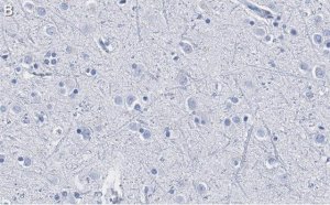 Anti-DKK3 Antibody, clone 3H17 ZooMAb� Rabbit Monoclonal 