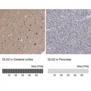 Anti-DLG2 antibody produced in rabbit 