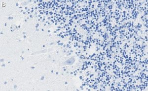 Anti-DNA Polymerase beta Antibody, clone 3F21 ZooMAb� Rabbit Monoclonal 