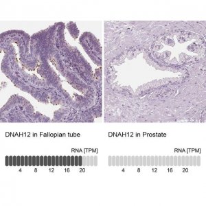 Anti-DNAH12 antibody produced in rabbit 
