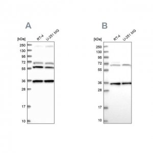 Anti-DNAJC17 antibody produced in rabbit 