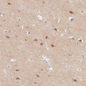 Anti-DNAJC6 antibody produced in rabbit 