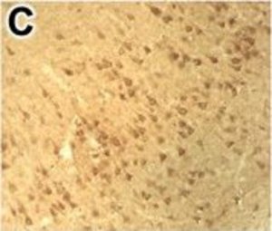 Anti-DNMT3B antibody produced in rabbit 