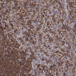 Anti-DOCK10 antibody produced in rabbit 