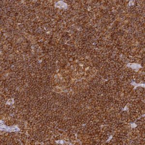 Anti-DOCK2 antibody produced in rabbit HPA036469-100UL