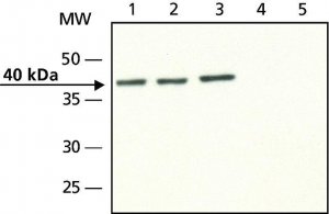 Anti-Doublecortin antibody produced in rabbit 
