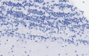 Anti-Doublecortin Antibody, clone 3F11 ZooMAb� Rabbit Monoclonal 