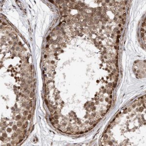 Anti-DUSP22 antibody produced in rabbit 