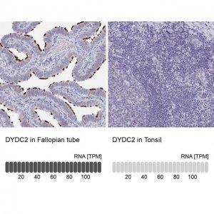 Anti-DYDC2 antibody produced in rabbit 