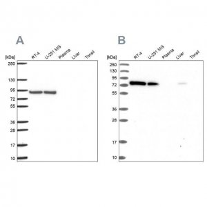 Anti-DYNC1I2 antibody produced in rabbit 