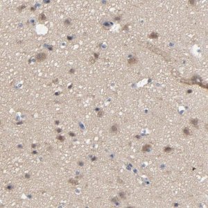 Anti-DYNLT3 antibody produced in rabbit 