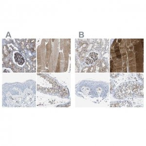 Anti-DYSF antibody produced in rabbit 