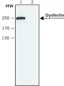 Anti-Dysferlin antibody produced in rabbit SAB4200387-200UL