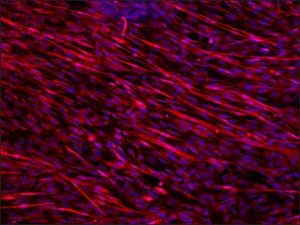 Anti-Dysferlin antibody produced in rabbit SAB4200387-200UL