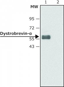 Anti-Dystrobrevin- antibody produced in rabbit SAB4200408-200UL