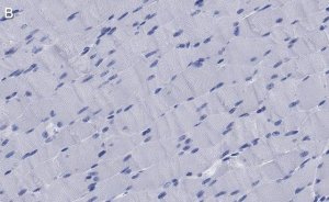 Anti-Dystrophin Antibody, clone 1G7, ZooMAb� Rabbit Monoclonal 