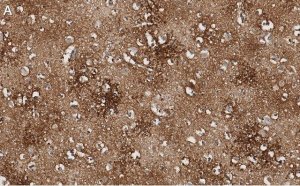 Anti-EAAT2 Antibody, clone 1K8 ZooMAb� Rabbit Monoclonal 