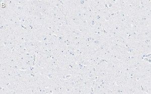 Anti-EAAT2 Antibody, clone 1K8 ZooMAb� Rabbit Monoclonal 