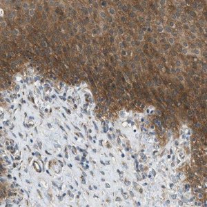 Anti-EDARADD antibody produced in rabbit 