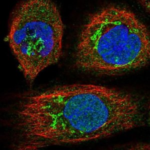 Anti-EDN1 antibody produced in rabbit 