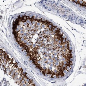 Anti-EFCAB7 antibody produced in rabbit 