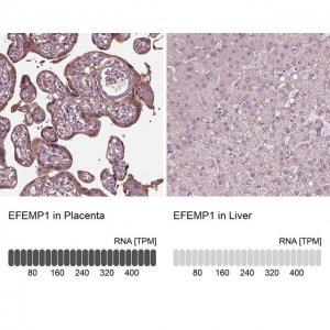 Anti-EFEMP1 antibody produced in rabbit 