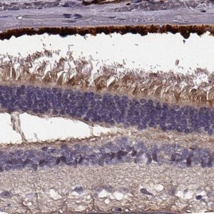 Anti-EFEMP1 antibody produced in rabbit 