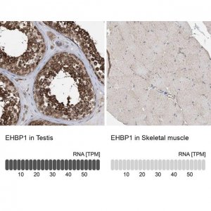 Anti-EHBP1 antibody produced in rabbit 