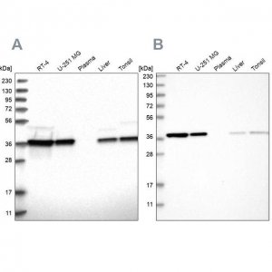 Anti-EIF3I antibody produced in rabbit 