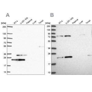 Anti-EIF3K antibody produced in rabbit 