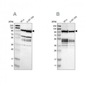 Anti-EIF4G2 antibody produced in rabbit 