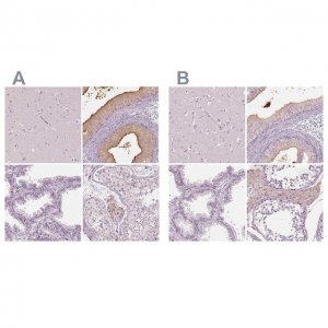 Anti-ELSPBP1 antibody produced in rabbit 