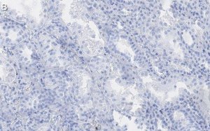 Anti-Endoglin Antibody, clone 1I15 ZooMAb� Rabbit Monoclonal 