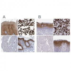 Anti-ENDOU antibody produced in rabbit 