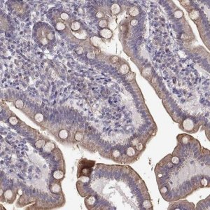 Anti-ENTPD8 antibody produced in rabbit 