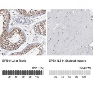 Anti-EPB41L3 antibody produced in rabbit 