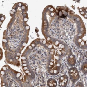 Anti-ERAL1 antibody produced in rabbit 